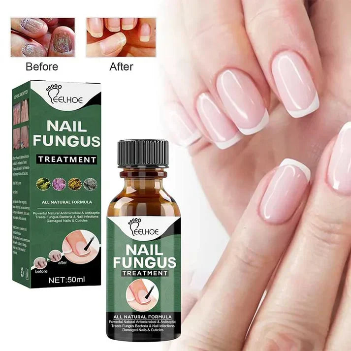 Nail Fungal Treatments